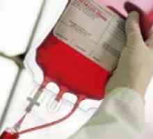 Grupa de compatibilitate Sânge și factorul Rh transfuzie