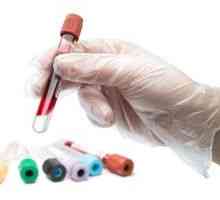 Un test de sânge pentru tuberculoză la copii: acuratețea și posibilitatea