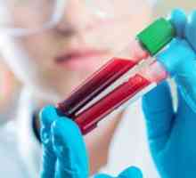 GGT în analiza biochimică a sângelui: valorile normale ale nivelului enzimatic.