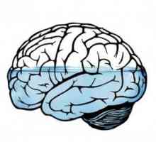 Hidrocefalie (edem al creierului): cauze, simptome, modul de a trata, efectele