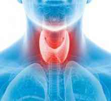 Hipertiroidismul: cauzele simptomelor și tactici medicale