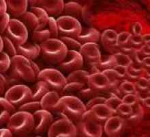 Hipercoagulabilitatea sângelui și tratamentul acesteia