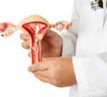 Hiperplazie endometriala - cum să identifice simptomele? diagnostic corect