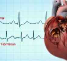 Simptomele de diferite forme de cardiomiopatie și diagnosticarea