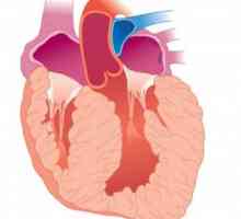 Hipertrofia miocardului ventricular, atriale: simptome, cauze, tratament, localizare