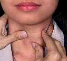 Noduli tiroidieni hypoechoic: cauzele și strategia de tratament