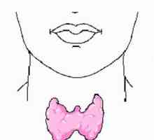 Hipoplazie a tiroidei