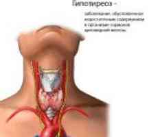 Hipotiroidismul glandei tiroide disfunctionale: cauze si simptome, medicamente și tratament, forme…