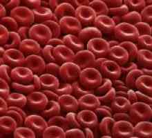 Principalele motive pentru scăderea în celulele roșii din sânge