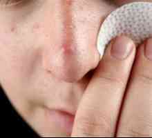 Histologie și tipuri de acnee