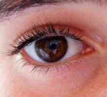 Presiune oculara: semne de creștere, simptome și tratament.