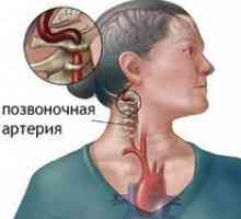 Dureri de cap în osteocondrozei a gâtului