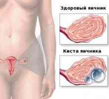 Natura durerii dureri în abdomen la bărbați și femei