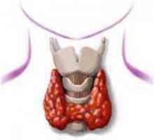 Simptomele caracteristice ale bolii tiroidiene la femei