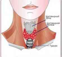 Simptomele caracteristice ale tulburări ale glandei tiroide
