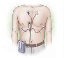 Monitorizare Holter (monitorizare Holter) EKG și iad: citire, care deține, preț, rezultate