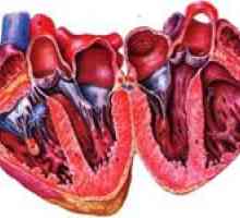 Simptomele de congenitale și defecte cardiace dobândite