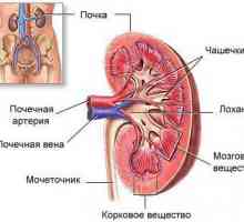 Pielonefrită cronică, infecția are un rinichi