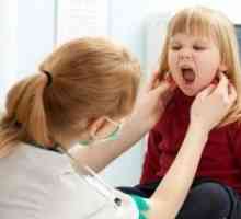 Mononucleoza infecțioasă: simptomele în copil. Opinia Dr. Komarovsky
