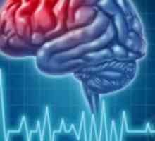 Accident vascular cerebral si atac de cord - un pericol care poate fi prevenită