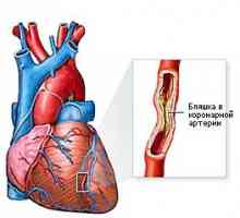 Boala coronariană (CHD)