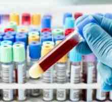 Test de sange pentru EIM