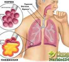 Cure remedii pneumonie populare la domiciliu