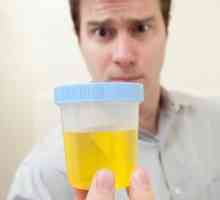Am schimbat mirosul de urină: tipurile de mirosuri și posibile boli