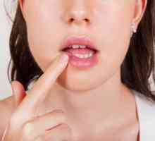 Medicamente eficiente impotriva herpesului pe buze