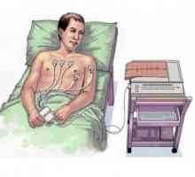 Electrocardiograma (ECG): teoria de bază, îndepărtarea, analiza, depistarea patologiilor