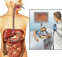 Endoscopie a stomacului - care este o procedură dată?