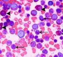 De ce se poate ridica eozinofile în sânge?