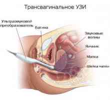 Cum ecografie vaginală: pregătirea, procedura și decodare