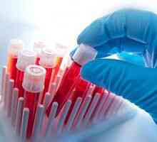 Cum și de ce ar trebui să doneze sânge pentru test de toxoplasmoza