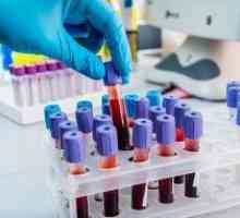 Cum și de ce test de sânge pentru zahăr cu sarcina?