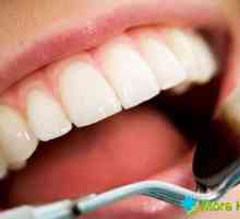 Oricât de mult doare gingiile după extracția dentară? Cauze patologica si tratament