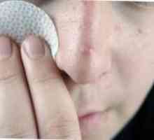 Cum de a trata acnee pe nas, și de ce apar?