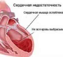 Cum de a trata insuficienta cardiaca