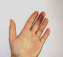 Cum pot elimina umflarea rapid și eficient cu degetele