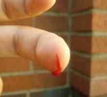 Cum de a opri sângerarea de la un deget