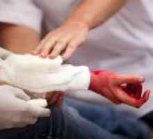 Caracteristici de sângerare venoasă și de îngrijire de urgență