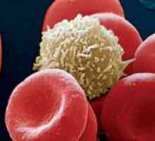 Cum de a crește celulele albe din sânge după chimioterapie?