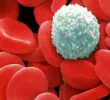Cum de a crește numărul de celule albe din sânge