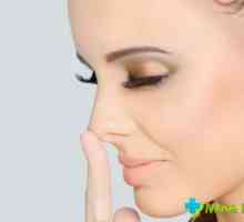 Ciuperca în nas: simptomele rinitei fungice