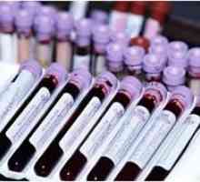Cum de a dona sange pentru hormoni tiroidieni