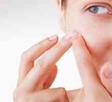 Cum se utilizează acid salicilic pentru acnee