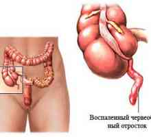 Cum este tratamentul bolii inflamatorii intestinale?