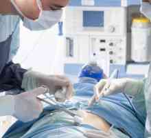 Cum este îndepărtarea uterului laparoscopic?