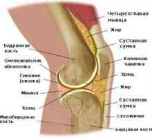Care sunt simptomele artritei genunchiului