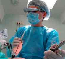 Cum este tubare laparoscopie